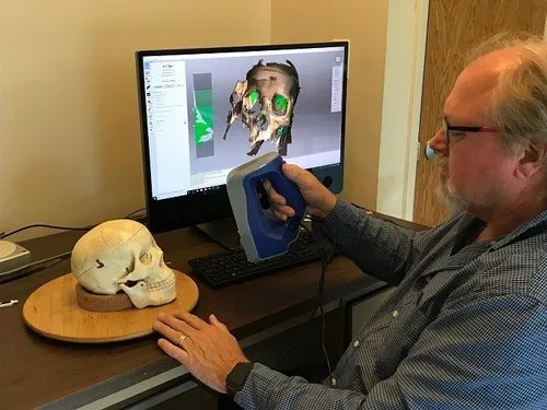 Máy quét laser 3d và lĩnh vực y tế